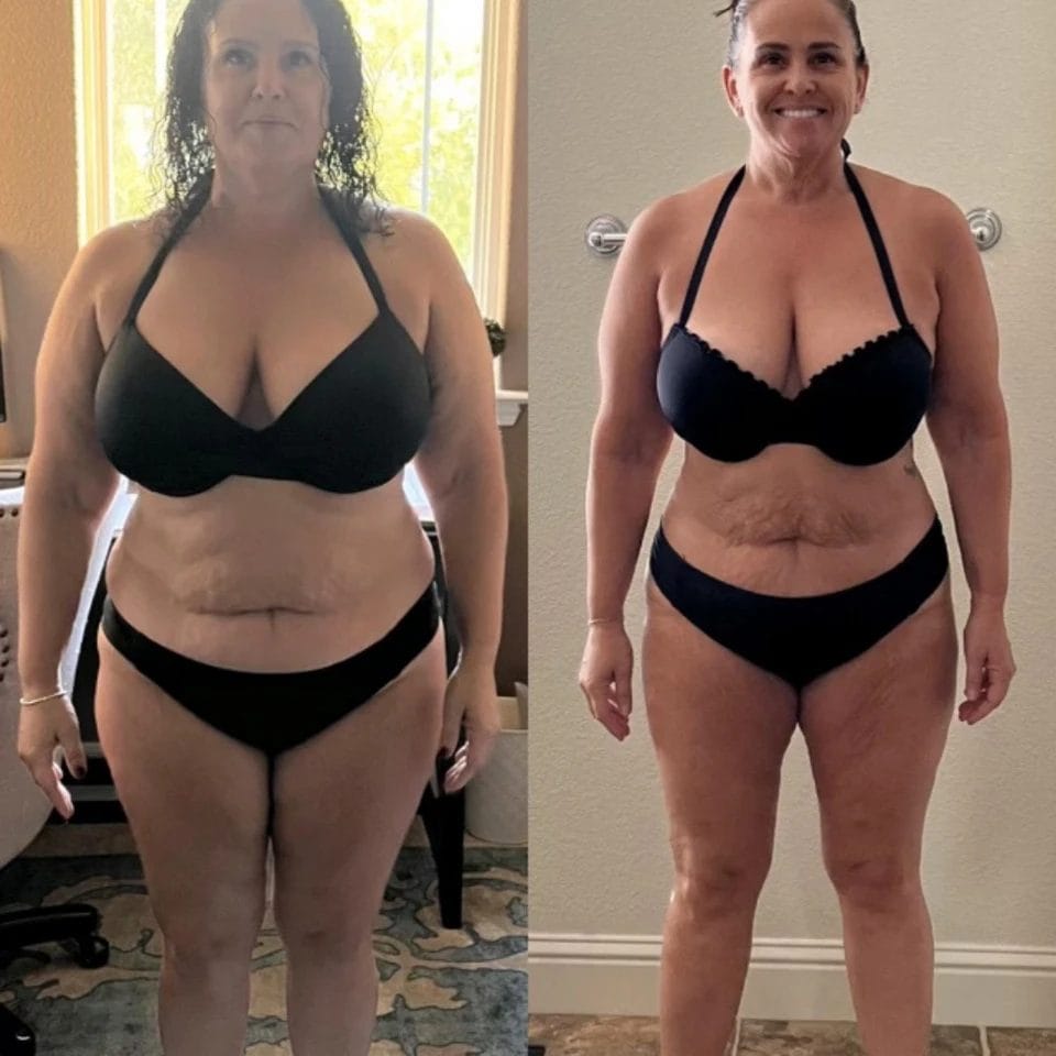 Woman posing before & after39