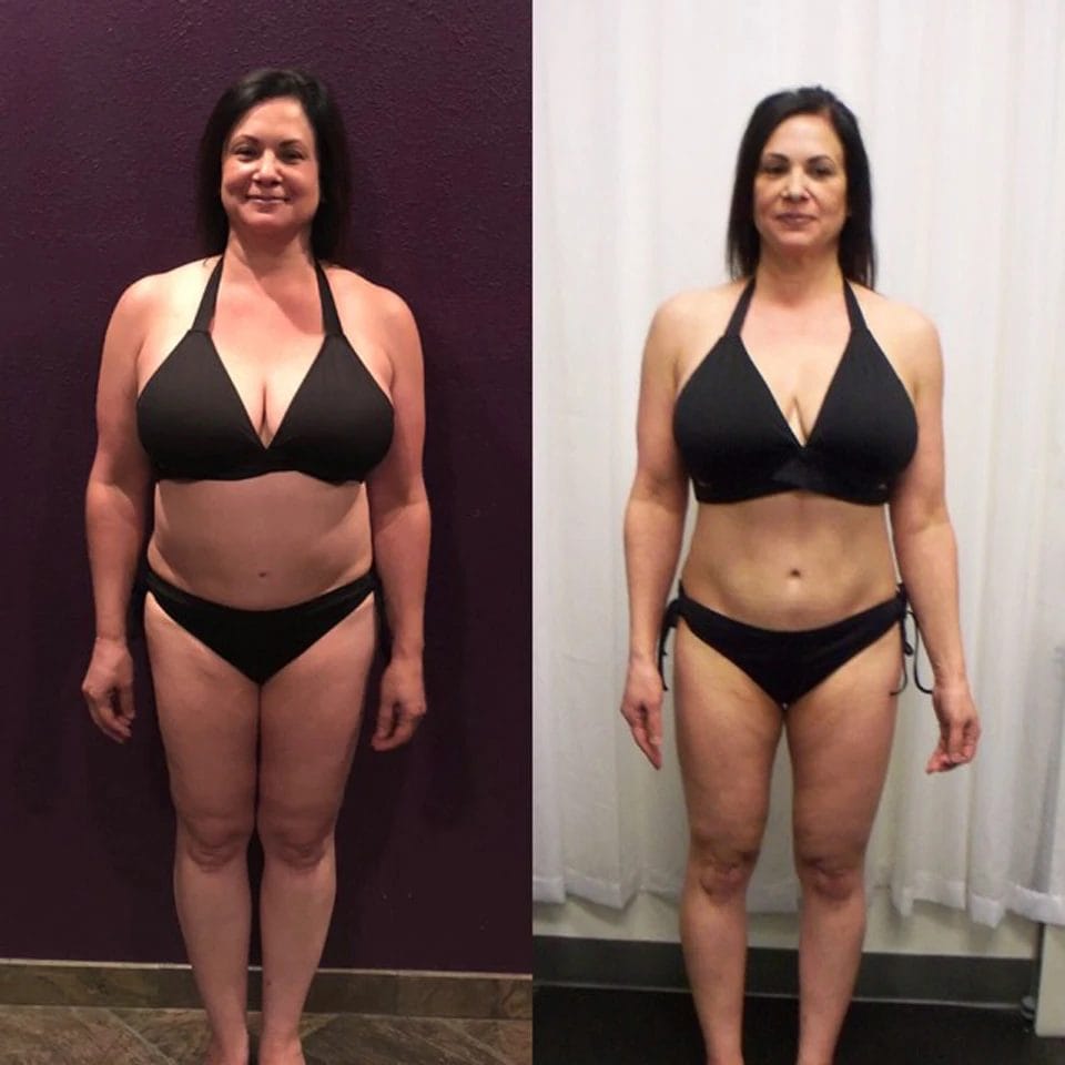 Woman posing before & after54